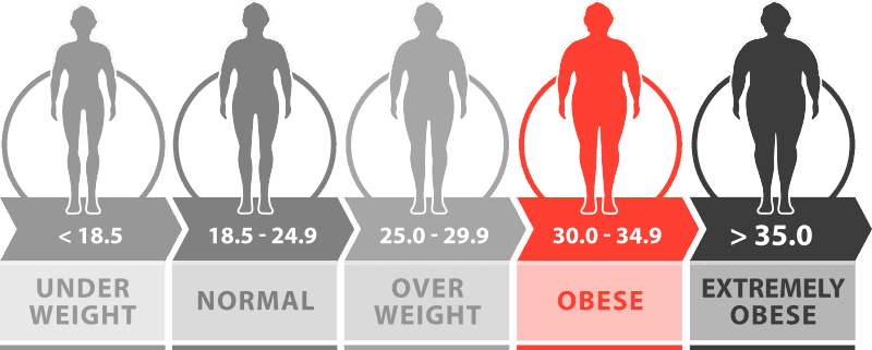 BMI weight loss obese BMI less than 30 - 34.9